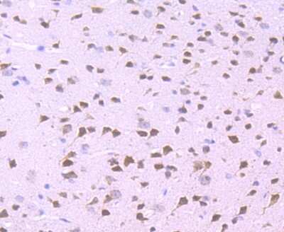 Immunohistochemistry-Paraffin: WDR5 Antibody (JM73-53) [NBP2-75711] - Analysis of paraffin-embedded mouse brain tissue using anti-WDR5 antibody. Counter stained with hematoxylin.