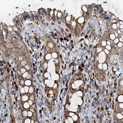 Immunohistochemistry-Paraffin: WDR51A Antibody [NBP1-88008] - Staining of human rectum shows strong granular cytoplasmic positivity in lymphoid cells.