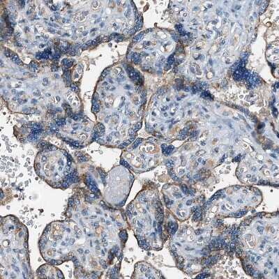 Immunohistochemistry-Paraffin: WDR51A Antibody [NBP1-88008] - Staining of human placenta shows moderate  granular cytoplasmic positivity in trophoblastic cells.