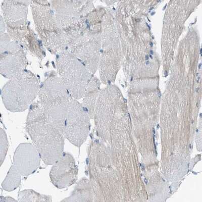 Immunohistochemistry-Paraffin: WDR51A Antibody [NBP1-88008] - Staining of human skeletal muscle shows no positivity in myocytes as expected.