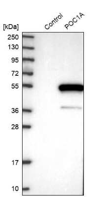 Western Blot: WDR51A Antibody [NBP1-88008] - Analysis in control (vector only transfected HEK293T lysate) and POC1A over-expression lysate (Co-expressed with a C-terminal myc-DDK tag (3.1 kDa) in mammalian HEK293T cells).