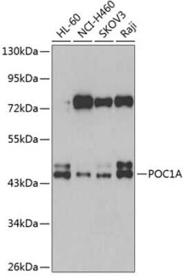 Western Blot: WDR51A Antibody [NBP2-93129] - Analysis of extracts of various cell lines, using WDR51A at 1:1000 dilution. Secondary antibody: HRP Goat Anti-Rabbit IgG (H+L) at 1:10000 dilution. Lysates/proteins: 25ug per lane. Blocking buffer: 3% nonfat dry milk in TBST. Detection: ECL Basic Kit . Exposure time: 90s.