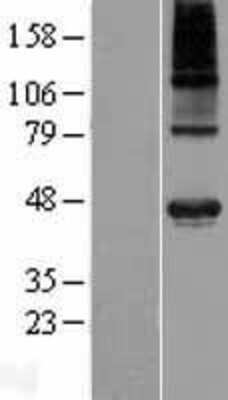 Western Blot: WDR51A Overexpression Lysate (Adult Normal) [NBP2-07180] Left-Empty vector transfected control cell lysate (HEK293 cell lysate); Right -Over-expression Lysate for WDR51A.