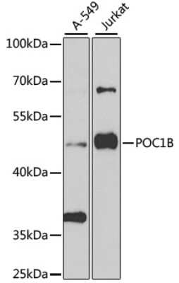 Western Blot WDR51B Antibody - BSA Free