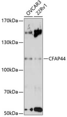 Western Blot: WDR52 Antibody [NBP2-93585] - Analysis of extracts of various cell lines, using CFAP44 antibody  at 1:3000 dilution.Secondary antibody: HRP Goat Anti-Rabbit IgG (H+L) at 1:10000 dilution.Lysates/proteins: 25ug per lane. Blocking buffer: 3% nonfat dry milk in TBST.Detection: ECL Enhanced Kit. Exposure time: 90s.