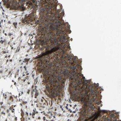 Immunohistochemistry-Paraffin: WDR53 Antibody [NBP1-82757] - Staining of human urinary bladder shows strong positivity in urothelial cells.