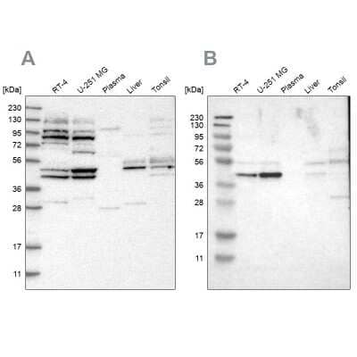Western Blot: WDR53 Antibody [NBP1-82757] - Analysis using Anti-WDR53 antibody NBP1-82757 (A) shows similar pattern to independent antibody NBP1-82758 (B).