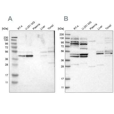 Western Blot: WDR53 Antibody [NBP1-82758] - Analysis using Anti-WDR53 antibody NBP1-82758 (A) shows similar pattern to independent antibody NBP1-82757 (B).