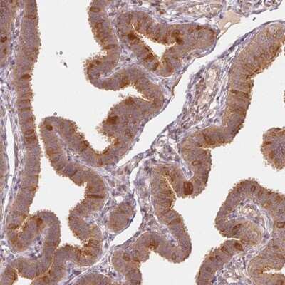 Immunohistochemistry-Paraffin: WDR54 Antibody [NBP1-82275] - Staining of human fallopian tube shows high expression.