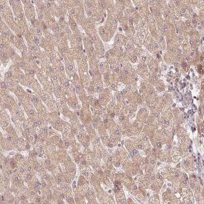 Immunohistochemistry-Paraffin: WDR54 Antibody [NBP1-82275] - Staining of human liver shows low expression as expected.