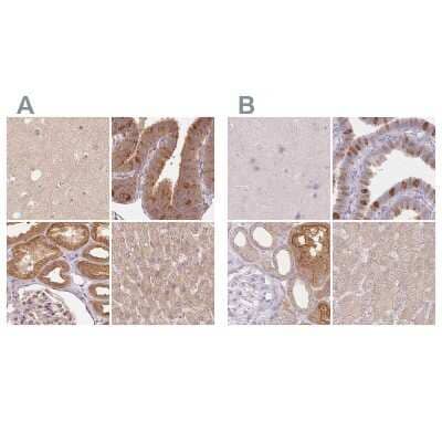 Immunohistochemistry-Paraffin: WDR54 Antibody [NBP1-82275] - Staining of human cerebral cortex, fallopian tube, kidney and liver using Anti-WDR54 antibody NBP1-82275 (A) shows similar protein distribution across tissues to independent antibody NBP2-38705 (B).