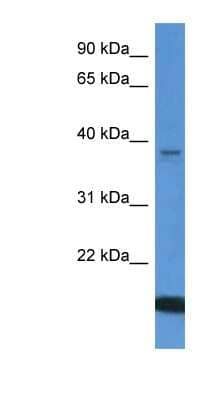 Western Blot: WDR54 Antibody [NBP1-79833] - Human Lung lysate, concentration 0.2-1 ug/ml.
