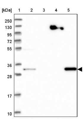 Western Blot: WDR54 Antibody [NBP1-82275] - Lane 1: Marker  [kDa] 250, 130, 95, 72, 55, 36, 28, 17, 10.  Lane 2: Human cell line RT-4.  Lane 3: Human cell line U-251MG sp.  Lane 4: Human plasma (IgG/HSA depleted).  Lane 5: Human liver tissue