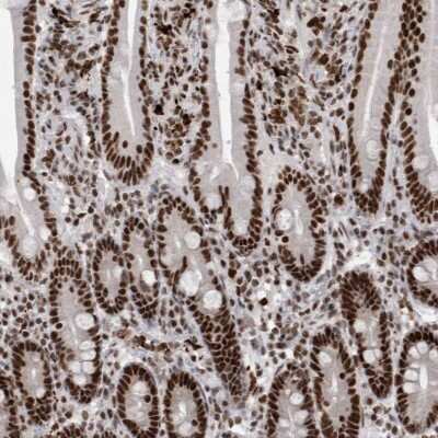 Immunohistochemistry-Paraffin: WDR57 Antibody [NBP1-92585] - Staining of human duodenum shows strong nuclear positivity in glandular cells.