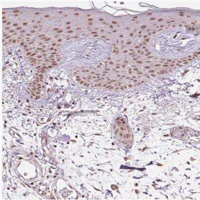 Immunohistochemistry-Paraffin: WDR58 Antibody [NBP2-31390] - Staining of human skin shows moderate nuclear positivity in keratinocytes.