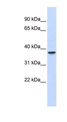 Western Blot: WDR58 Antibody [NBP1-56356] - Human Pancrease lysate, concentration 0.2-1 ug/ml.