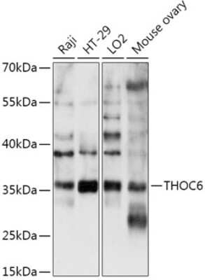 Western Blot: WDR58 Antibody [NBP2-94392] - Analysis of extracts of various cell lines, using WDR58 at 1:1000 dilution. Secondary antibody: HRP Goat Anti-Rabbit IgG (H+L) at 1:10000 dilution. Lysates/proteins: 25ug per lane. Blocking buffer: 3% nonfat dry milk in TBST. Detection: ECL Basic Kit . Exposure time: 180s.