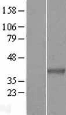 Western Blot: WDR58 Overexpression Lysate (Adult Normal) [NBL1-16891] Left-Empty vector transfected control cell lysate (HEK293 cell lysate); Right -Over-expression Lysate for WDR58.