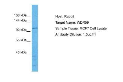 Western Blot: WDR59 Antibody [NBP2-86377] - Host: Rabbit. Target Name: WDR59. Sample Type: MCF7 Whole Cell lysates. Antibody Dilution: 1.0ug/mlWDR59 is strongly supported by BioGPS gene expression data to be expressed in Human MCF7 cells