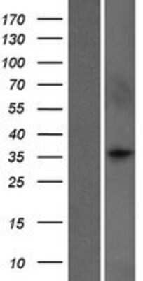 Western Blot: WDR5B Overexpression Lysate (Adult Normal) [NBP2-06728] Left-Empty vector transfected control cell lysate (HEK293 cell lysate); Right -Over-expression Lysate for WDR5B.
