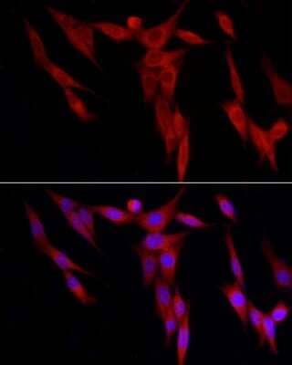 Immunocytochemistry/Immunofluorescence: WDR6 Antibody [NBP2-93695] - Immunofluorescence analysis of NIH/3T3 cells using WDR6 Rabbit pAb (NBP2-93695) at dilution of 1:250 (40x lens). Blue: DAPI for nuclear staining.