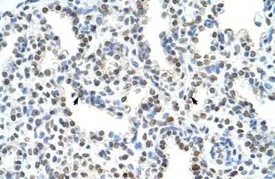 Immunohistochemistry: WDR6 Antibody [NBP1-54844] - Paraffin Embedded Tissue: Human Lung Cellular Data: Alveolar cells Antibody Concentration: 4.0 - 8.0 ug/ml Magnification: 400X