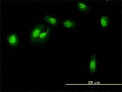 Immunocytochemistry/Immunofluorescence: WDR61 Antibody (3E5-1A12) [H00080349-M01] - Analysis of monoclonal antibody to WDR61 on HeLa cell. Antibody concentration 10 ug/ml.