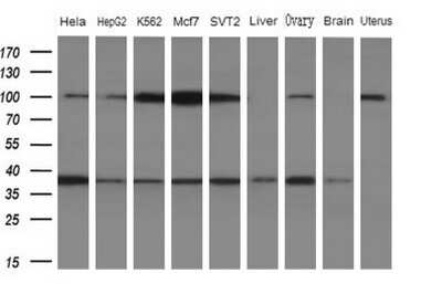 Western Blot: WDR61 Antibody (4C4) [NBP2-46359] - Analysis of extracts (10ug) from 5 different cell lines and 4 human tissue (1: Hela; 2: HepG2; 3: K562; 4: Mcf7; 5: SVT2; 6: Liver; 7: Testis; 8: Brain; 9: Uterus)