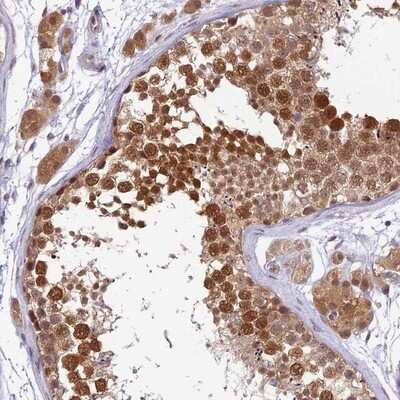 Immunohistochemistry-Paraffin: WDR61 Antibody [NBP1-80845] - Staining of human testis shows strong cytoplasmic and nuclear positivity in cells in seminiferus ducts.
