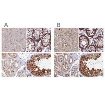 <b>Independent Antibodies Validation. </b>Immunohistochemistry-Paraffin: WDR61 Antibody [NBP1-80845] - Staining of human cerebral cortex, colon, kidney and testis using Anti-WDR61 antibody NBP1-80845 (A) shows similar protein distribution across tissues to independent antibody NBP1-80844 (B).