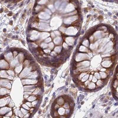 Immunohistochemistry-Paraffin: WDR61 Antibody [NBP1-80845] - Staining of human colon.