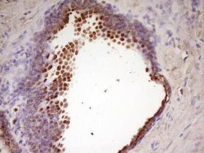 Immunohistochemistry: WDR61 Antibody (OTI4C4) - Azide and BSA Free [NBP2-74866] - Analysis of Human prostate tissue. (Heat-induced epitope retrieval by 1 mM EDTA in 10mM Tris, pH8.5, 120C for 3min)