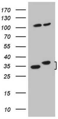 Western Blot: WDR61 Antibody (OTI4C4) - Azide and BSA Free [NBP2-74866] - Analysis of HEK293T cells were transfected with the pCMV6-ENTRY control (Left lane) or pCMV6-ENTRY WDR61.