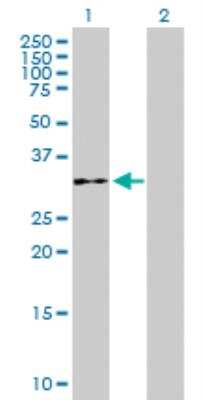 Western Blot: WDR61 Antibody [H00080349-B01P] - analysis of WDR61 expression in transfected 293T cell line by WDR61 MaxPab polyclonal antibody. Lane 1: WDR61 transfected lysate (33.55 KDa). Lane 2: Non-transfected lysate.