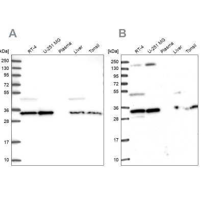 Western Blot: WDR61 Antibody [NBP1-80845] - Analysis using Anti-WDR61 antibody NBP1-80845 (A) shows similar pattern to independent antibody NBP1-80844 (B).