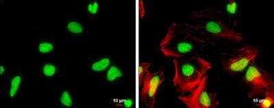 Immunocytochemistry/ Immunofluorescence WDR62 Antibody