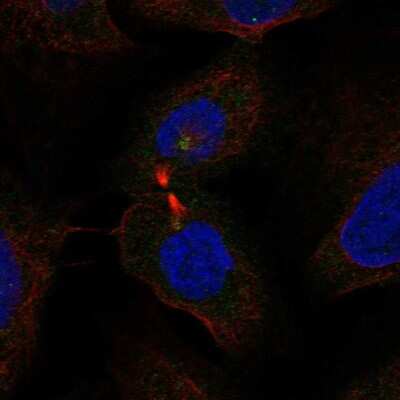 Immunocytochemistry/Immunofluorescence: WDR62 Antibody [NBP2-48788] - Staining of human cell line U-2 OS shows localization to microtubule organizing center. Antibody staining is shown in green.