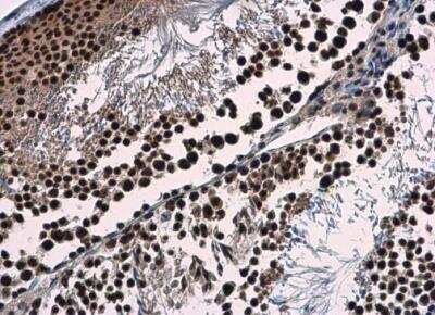 Immunohistochemistry-Paraffin WDR62 Antibody