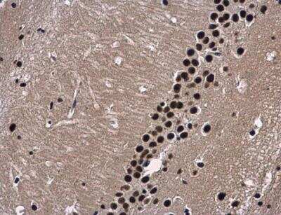 Immunohistochemistry-Paraffin WDR62 Antibody