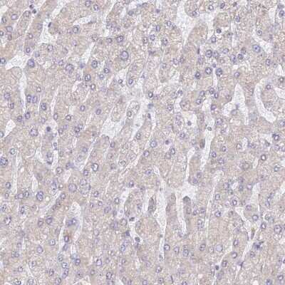 <b>Orthogonal Strategies Validation. </b>Immunohistochemistry-Paraffin: WDR62 Antibody [NBP2-47582] - Staining of human liver shows low expression as expected.