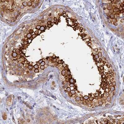 Immunohistochemistry-Paraffin: WDR62 Antibody [NBP2-47582] - Staining of human testis shows high expression.