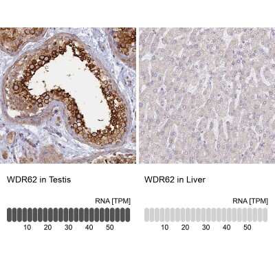 Immunohistochemistry-Paraffin: WDR62 Antibody [NBP2-47582] - Staining in human testis and liver tissues using anti-WDR62 antibody. Corresponding WDR62 RNA-seq data are presented for the same tissues.