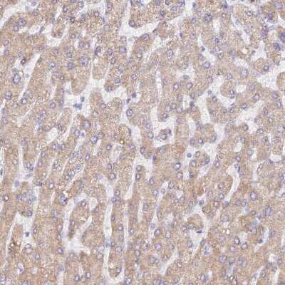 Immunohistochemistry-Paraffin: WDR62 Antibody [NBP2-48788] - Staining of human liver shows low expression as expected.