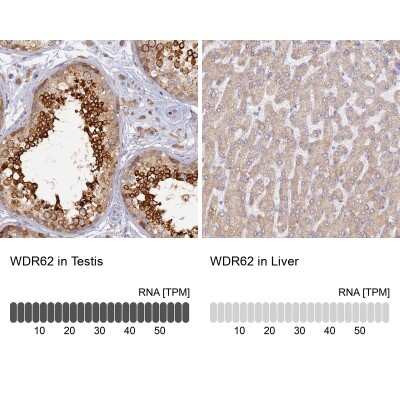 <b>Orthogonal Strategies Validation. </b>Immunohistochemistry-Paraffin: WDR62 Antibody [NBP2-48788] - Staining in human testis and liver tissues using anti-WDR62 antibody. Corresponding WDR62 RNA-seq data are presented for the same tissues.