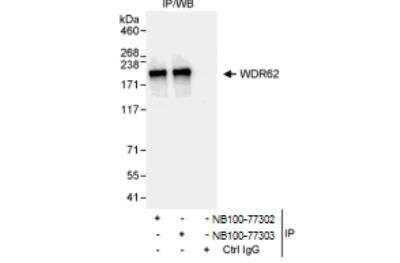 Immunoprecipitation: WDR62 Antibody [NB100-77302] - Whole cell lysate (1 mg for IP, 20% of IP loaded) from HeLa cells. Antibodies: Affinity purified rabbit anti-WDR62 antibody NB100-77302 used for IP at 3 ug/mg lysate. WDR62 was also immunoprecipitated by rabbit anti WDR62 antibody NB100-77303 which recognizes a downstream epitope. For blotting immunoprecipitated WDR62, NB100-77303 was used at 1 ug/ml. Detection: Chemiluminescence with an exposure time of 3 seconds.