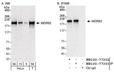 Western Blot: WDR62 Antibody [NB100-77303] - Detection of Human WDR62 on HeLa whole cell lysate using NB100-77303. WDR62 was also immunoprecipitated by rabbit anti-WDR62 antibody NB100-77302.