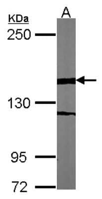 Western Blot: WDR62 Antibody [NBP2-20897] - Sample (30 ug of whole cell lysate) A:NIH-3T3 5% SDS PAGE gel, diluted at 1:1000.