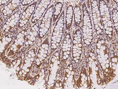 Immunohistochemistry-Paraffin WDR64 Antibody - BSA Free