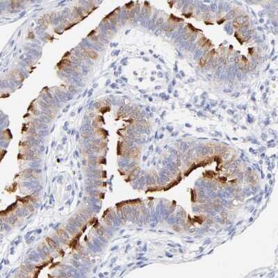 Immunohistochemistry-Paraffin: WDR65 Antibody [NBP1-82009] - Staining of human fallopian tube shows high expression.