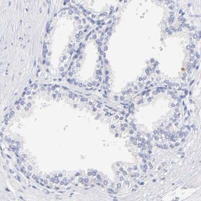 Immunohistochemistry-Paraffin: WDR65 Antibody [NBP1-82009] - Staining of human prostate shows low expression as expected.